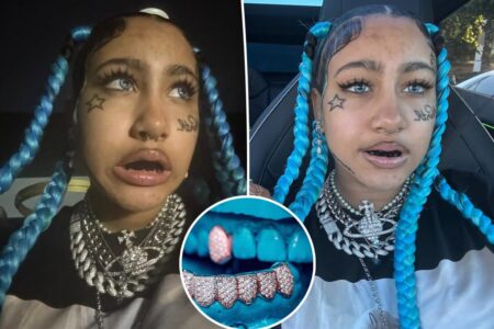 Dentists warn kids against viral TikTok trend resulting in ‘damage they’ll carry for decades’ Dentists warn kids against viral TikTok trend resulting in ‘damage they’ll carry for decades’